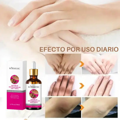 Kormesic® Serum Blanqueador de Nudillos
